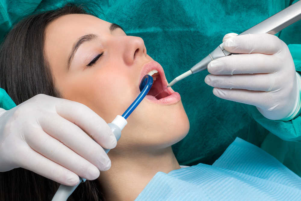¿En qué consiste la limpieza dental con ultrasonido?